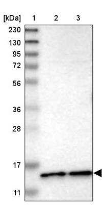 Western Blot: CDPF1 Antibody [NBP1-81297] -  Lane 1: Marker  [kDa] 230, 130, 95, 72, 56, 36, 28, 17, 11.  Lane 2: Human cell line RT-4.  Lane 3: Human cell line U-251MG sp