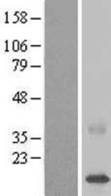 Western Blot: C22orf40 Overexpression Lysate (Adult Normal) [NBL1-08400] Left-Empty vector transfected control cell lysate (HEK293 cell lysate); Right -Over-expression Lysate for C22orf40.