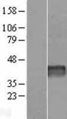 Western Blot: Aspartate Rich 1 Overexpression Lysate [NBP2-07035] - Left-Empty vector transfected control cell lysate (HEK293 cell lysate); Right -Over-expression Lysate for Aspartate Rich 1.