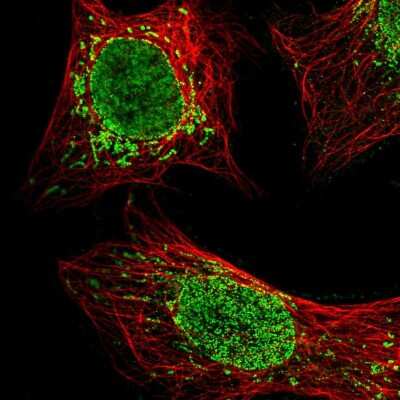 Immunocytochemistry/Immunofluorescence: C22orf9 Antibody [NBP1-89965] - Staining of human cell line U-2 OS shows localization to nucleoplasm, nuclear membrane & mitochondria. Antibody staining is shown in green.