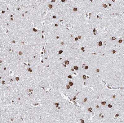 Immunohistochemistry-Paraffin: C22orf9 Antibody [NBP1-89965] - Staining of human cerebral cortex shows strong nuclear membrane positivity in neuronal cells.