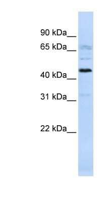 Western Blot: C22orf9 Antibody [NBP1-70465] - 721_B cell lysate, concentration 0.2-1 ug/ml.