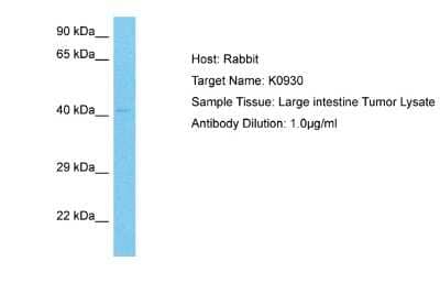 Western Blot: C22orf9 Antibody [NBP2-84552] - WB Suggested Anti-K0930 antibody Titration: 1 ug/mL. Sample Type: Human Large intestine Tumor