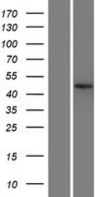 Western Blot: C22orf9 Overexpression Lysate (Adult Normal) [NBP2-10290] Left-Empty vector transfected control cell lysate (HEK293 cell lysate); Right -Over-expression Lysate for C22orf9.