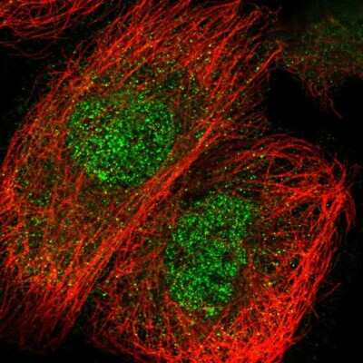 Immunocytochemistry/ Immunofluorescence C2CD2 Antibody