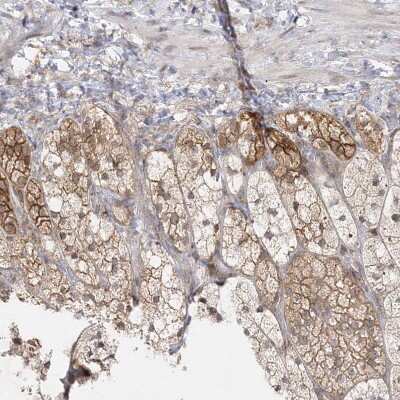 Immunohistochemistry-Paraffin C2CD2 Antibody