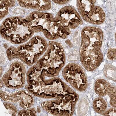 Immunohistochemistry-Paraffin C2CD2 Antibody