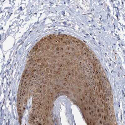 Immunohistochemistry: C2CD3 Antibody [NBP2-38416] - Staining of human vulva/anal skin shows moderate nucleolar and cytoplasmic positivity in epidermal cells.