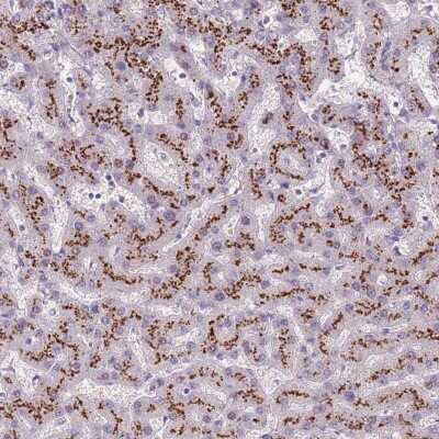 Immunohistochemistry: C2CD3 Antibody [NBP2-38466] - Staining of human liver shows strong cytoplasmic positivity with a granular pattern positivity in hepatocytes.