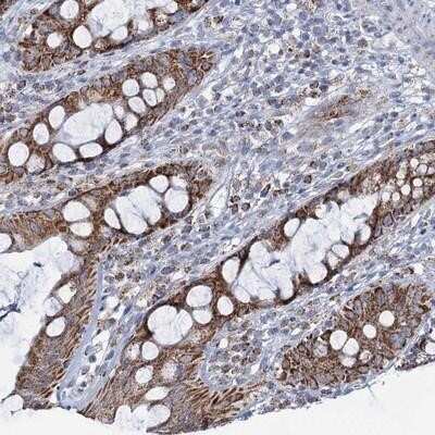 Immunohistochemistry-Paraffin C2CD3 Antibody