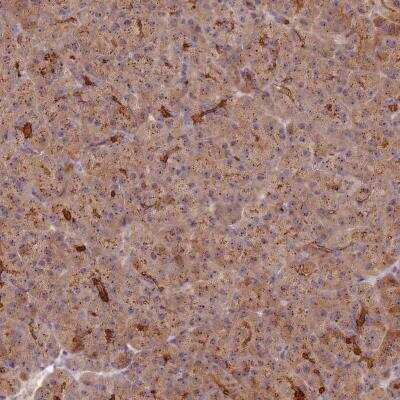 Immunohistochemistry-Paraffin C2CD4B Antibody