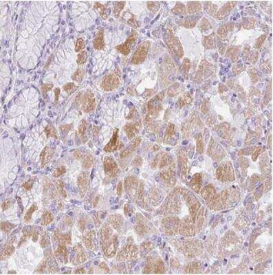 Immunohistochemistry: C2CD4C Antibody [NBP2-30575] - Staining of human stomach, upper shows moderate cytoplasmic positivity in glandular cells.