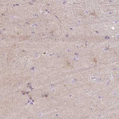 Immunohistochemistry-Paraffin: C2CD4C Antibody [NBP2-30575] - Staining of human cerebral cortex shows weak cytoplasmic positivity in neuropil.
