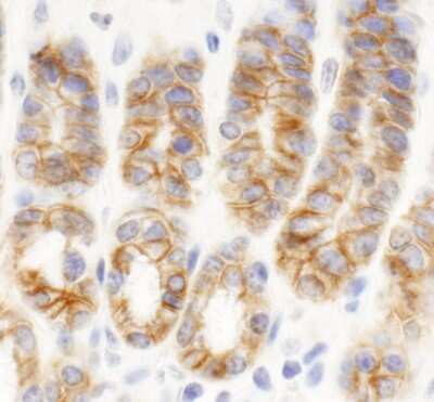 Immunohistochemistry: C2CD5 Antibody [NB100-74596] - Sample: FFPE section of mouse intestine. Antibody: Affinity purified rabbit anti-KIAA0528 used at a dilution of 1:400 (2.5ug/ml). Detection: DAB