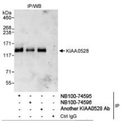 Immunoprecipitation: C2CD5 Antibody [NB100-74595] - Detection of Human KIAA0528 by Western Blot of  Immunoprecipitates. Samples: Whole cell lysate (1 mg for IP,  20% of IP loaded) from HeLa cells. Antibodies: Affinity purified  rabbit anti-KIAA0528 antibody NB100-74595 used for IP at 3  mcg/mg lysate. KIAA0528 was also immunoprecipitated by another  rabbit anti-KIAA0528 antibody and NB100-74596, which recognize downstream epitopes. Detection: Chemiluminescence with  an exposure time of 30 seconds.