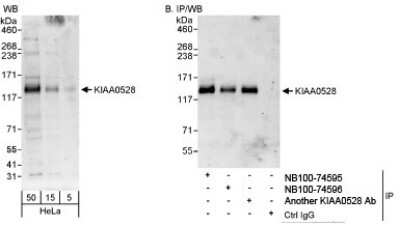 Western Blot: C2CD5 Antibody [NB100-74596] - Detection of Human KIAA0528 on HeLa whole cell lysate (5, 15, 50 microgram for WB; 1 mg for IP, 20% of IP loaded) using NB100-74596. KIAA0528 was also immunoprecipitated by another rabbit anti-KIAA0528 antibody and NB100-74595.