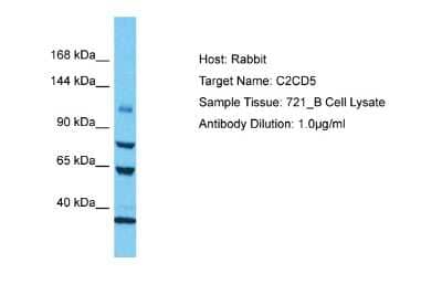 Western Blot: C2CD5 Antibody [NBP2-87101] - Host: Rabbit. Target Name: C2CD5. Sample Type: 721_B Whole Cell lysates. Antibody Dilution: 1.0ug/ml