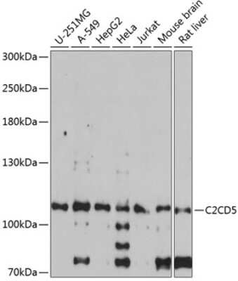 Western Blot: C2CD5 Antibody [NBP2-92738] - Analysis of extracts of various cell lines, using C2CD5 at 1:1000 dilution.Secondary antibody: HRP Goat Anti-Rabbit IgG (H+L) at 1:10000 dilution.Lysates/proteins: 25ug per lane.Blocking buffer: 3% nonfat dry milk in TBST.Detection: ECL Basic Kit .Exposure time: 90s.