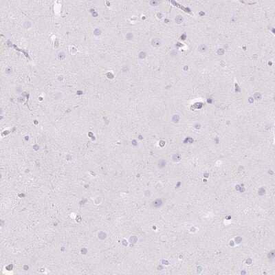 Immunohistochemistry-Paraffin: C2orf37 Antibody [NBP2-30715] - Staining of human cerebral cortex shows no positivity.