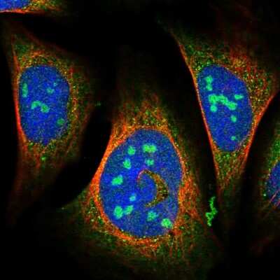 Immunocytochemistry/Immunofluorescence: C2orf44 Antibody [NBP1-83612] - Immunofluorescent staining of human cell line U-2 OS shows localization to nucleoli & cytosol.