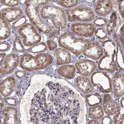 Immunohistochemistry: C2orf47 Antibody [NBP2-68933] - Immunohistochemical staining of human kidney shows strong cytoplasmic positivity in cells in tubules.