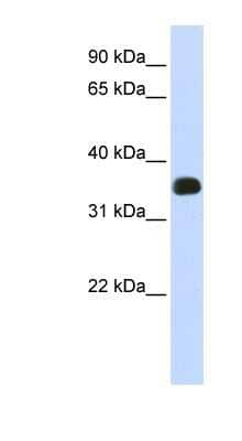 Western Blot: C2orf47 Antibody [NBP1-57840] - Human Liver cell lysate, concentration 0.2-1 ug/ml.