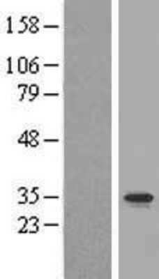 Western Blot: C2orf47 Overexpression Lysate (Adult Normal) [NBL1-08415] Left-Empty vector transfected control cell lysate (HEK293 cell lysate); Right -Over-expression Lysate for C2orf47.