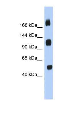Western Blot: C2orf55 Antibody [NBP1-70468] - Titration: 0.2-1 ug/ml, Positive Control: Human Placenta.