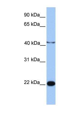 Western Blot: C2orf68 Antibody [NBP1-70469] - Jurkat cell lysate, concentration 0.2-1 ug/ml.