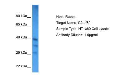 Western Blot: C2orf69 Antibody [NBP2-82893] - Host: Rabbit. Target Name: C2ORF69. Sample Tissue: HT1080 Whole Cell lysates. Antibody Dilution: 1ug/ml