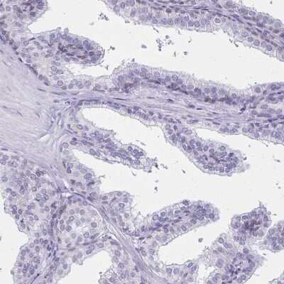 Immunohistochemistry-Paraffin: C2orf70 Antibody [NBP2-32360] - Staining of human prostate shows low expression as expected.