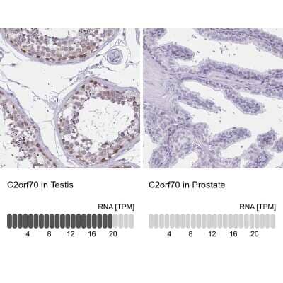 Immunohistochemistry-Paraffin: C2orf70 Antibody [NBP2-32360] - Staining in human testis and prostate tissues using anti-C2orf70 antibody. Corresponding C2orf70 RNA-seq data are presented for the same tissues.