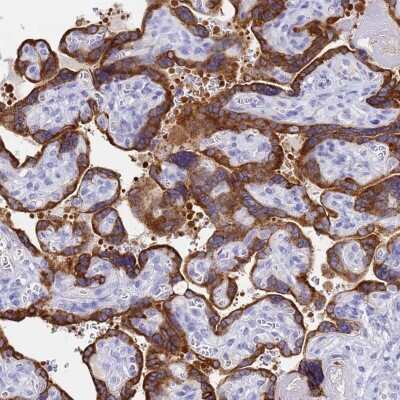 Immunohistochemistry-Paraffin: C2orf72 Antibody [NBP1-93551] - Staining of human placenta shows strong cytoplasmic positivity in trophoblastic cells.
