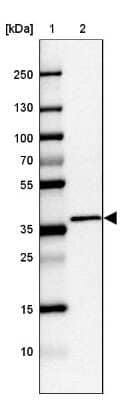 Western Blot: C2orf72 Antibody [NBP1-93551] - Lane 1: Marker [kDa] 250, 130, 100, 70, 55, 35, 25, 15, 10Lane 2: Human cell line CACO-2