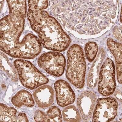 Immunohistochemistry: C2orf73 Antibody [NBP2-49301] - Staining of human kidney shows strong cytoplasmic positivity in renal tubules.