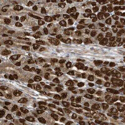 Immunohistochemistry-Paraffin: C2orf74 Antibody [NBP1-93548] - Staining of human stomach shows strong cytoplasmic positivity in parietal cells.