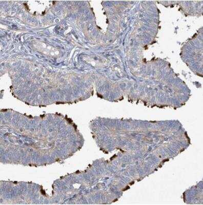 Immunohistochemistry: C2orf77 Antibody [NBP2-30912] - Staining of human fallopian tube shows distinct positivity in cilia.