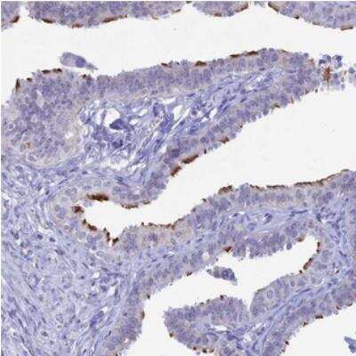 Immunohistochemistry CCDC173 Antibody - BSA Free