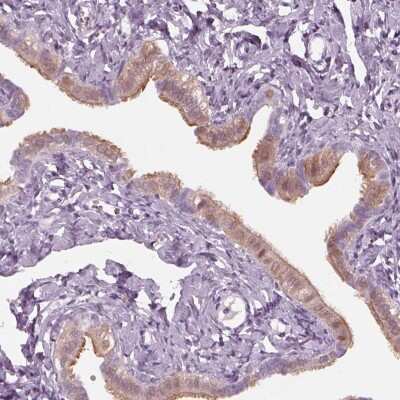 Immunohistochemistry-Paraffin: C2orf81 Antibody [NBP2-58395] - Staining of human fallopian tube shows high expression.