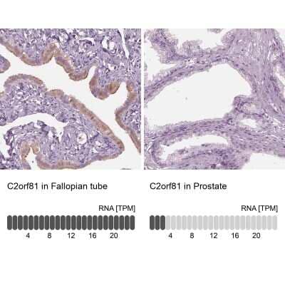 Immunohistochemistry-Paraffin: C2orf81 Antibody [NBP2-58395] - Staining in human fallopian tube and prostate tissues using anti-C2orf81 antibody. Corresponding C2orf81 RNA-seq data are presented for the same tissues.