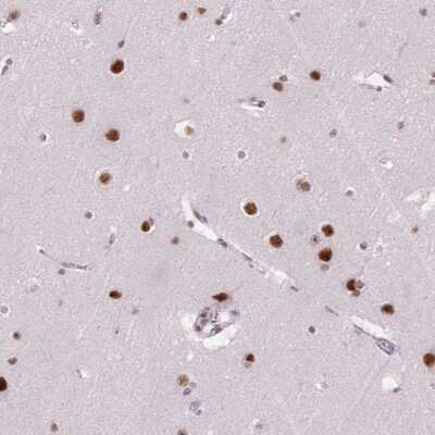 Immunohistochemistry-Paraffin SNORC Antibody - BSA Free
