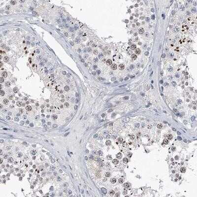 Immunohistochemistry-Paraffin: C2orf83 Antibody [NBP1-90540] - Staining of human testis shows nuclear positivity in subsets of cells in seminiferus ducts.