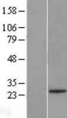Western Blot: C2orf84 Overexpression Lysate (Adult Normal) [NBL1-10762] Left-Empty vector transfected control cell lysate (HEK293 cell lysate); Right -Over-expression Lysate for C2orf84.