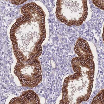 Immunohistochemistry-Paraffin C2orf88 Antibody - BSA Free
