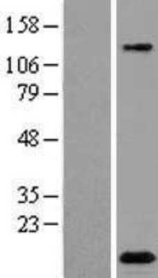 Western Blot: C2orf88 Overexpression Lysate (Adult Normal) [NBP2-08382] Left-Empty vector transfected control cell lysate (HEK293 cell lysate); Right -Over-expression Lysate for C2orf88.