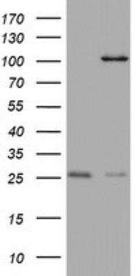 Western Blot: C3orf15 Antibody (OTI6G1) [NBP2-45449] - C3orf15 Antibody (6G1) [NBP2-45449] - Analysis of HEK293T cells were transfected with the pCMV6-ENTRY control (Left lane) or pCMV6-ENTRY C3orf15.