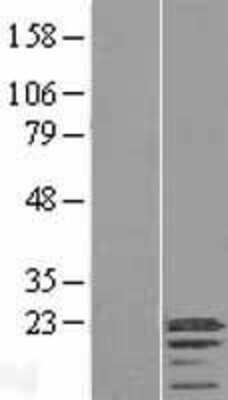 Western Blot: C3orf18 Overexpression Lysate (Adult Normal) [NBL1-08435] Left-Empty vector transfected control cell lysate (HEK293 cell lysate); Right -Over-expression Lysate for C3orf18.