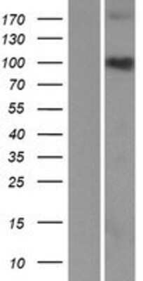 Western Blot: C3orf20 Overexpression Lysate (Adult Normal) [NBP2-06076] Left-Empty vector transfected control cell lysate (HEK293 cell lysate); Right -Over-expression Lysate for C3orf20.