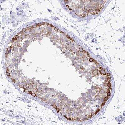 Immunohistochemistry-Paraffin: C3orf22 Antibody [NBP2-31754] - Staining of human testis shows strong cytoplasmic positivity in spermatogonia.