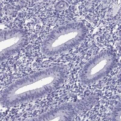 Immunohistochemistry-Paraffin: C3orf22 Antibody [NBP2-31754] - Staining of human endometrium shows low expression as expected.